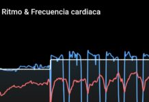 Lectura del ritmo cardiaco: Series